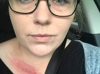Woman hit by wing-mirror the day before her wedding