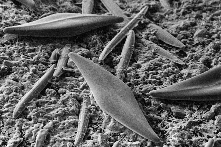 Surface entronmicrograph of mudflat diatoms - Gatty Lab., St.Andrews University