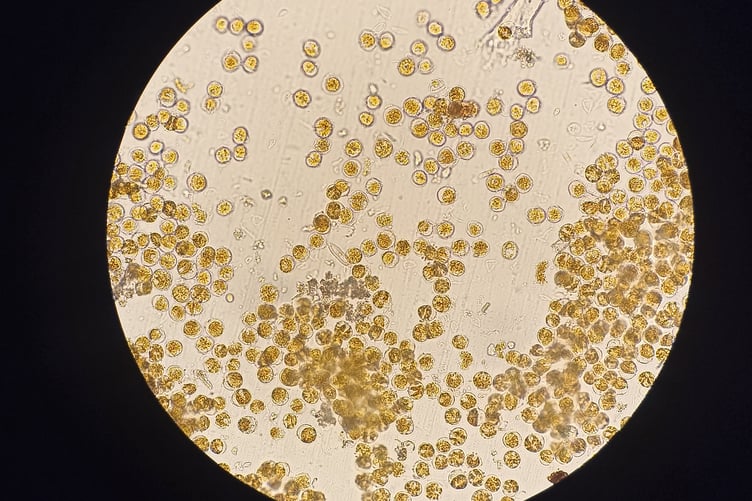 Alexandrium species of dinoflagellates from the present Kingsbridge Creek bloom 2026