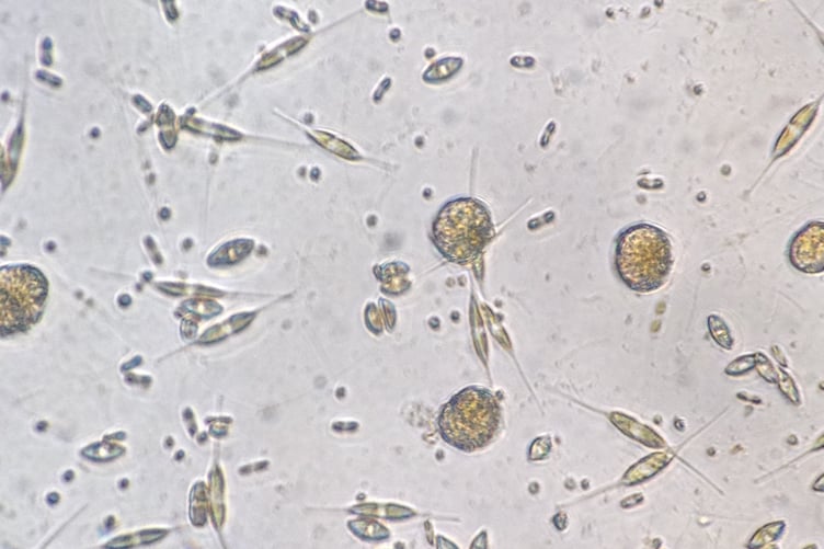 Plankton from a trawl in 2014 - ovoid pips are mudflat diatoms - long-pointy cells a Ceratium species of dinoflagellate - granular balls an Alexandrium dinoflagellate